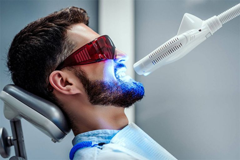Clareamento Dental – Indaial – Santa Catarina – Neo Prime Odontologia Clareamento Dental - Indaial - Santa Catarina - Neo Prime Odontologia
