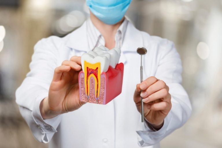 Endodontia/Tratamento de Canal – Indaial – Santa Catarina – Neo Prime Odontologia Endodontia/Tratamento de Canal - Indaial - Santa Catarina - Neo Prime Odontologia