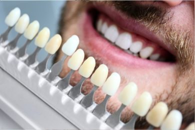 Facetas Dentárias – Indaial – Santa Catarina – Neo Prime Odontologia Facetas Dentárias - Indaial - Santa Catarina - Neo Prime Odontologia